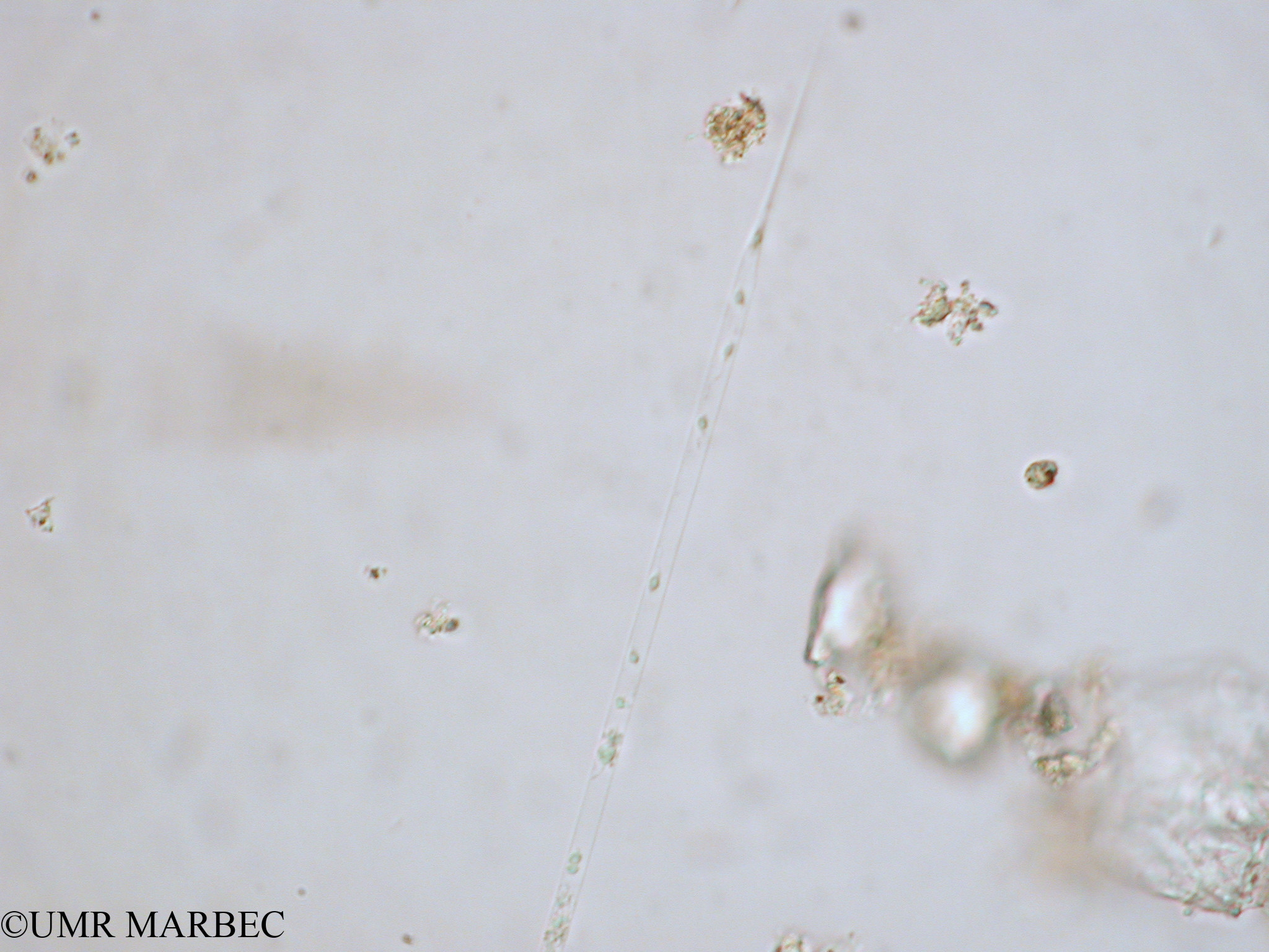 phyto/Tulear Lagoon/all/ICAR2 Avril 2008/Rhizosolenia setigera (Cell effilée Rhizosolenia sp1 x1.5x40 b)(copy).jpg
